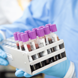 imagen-diagnostica-diagnostico-de-las-americas-blood-test-sangre-analisis-lab-analysis